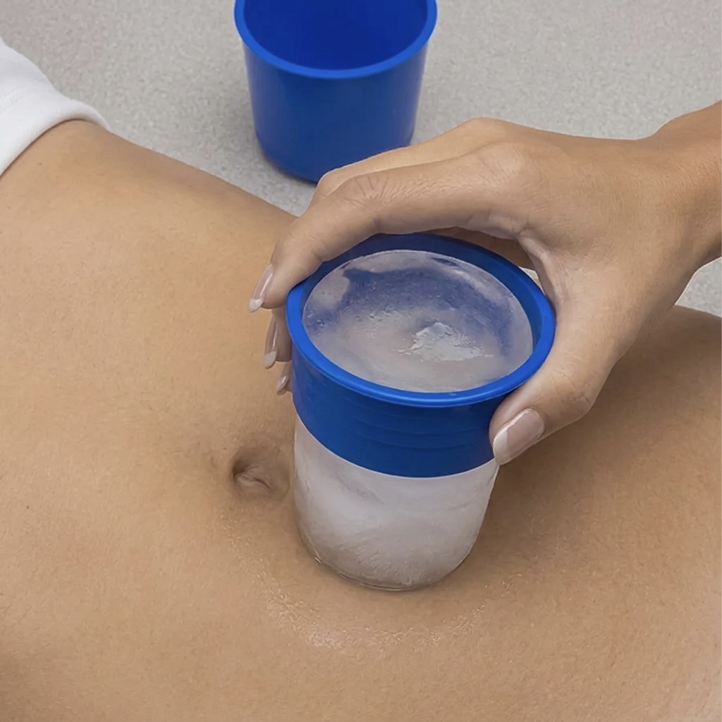 Body Cryotherapy