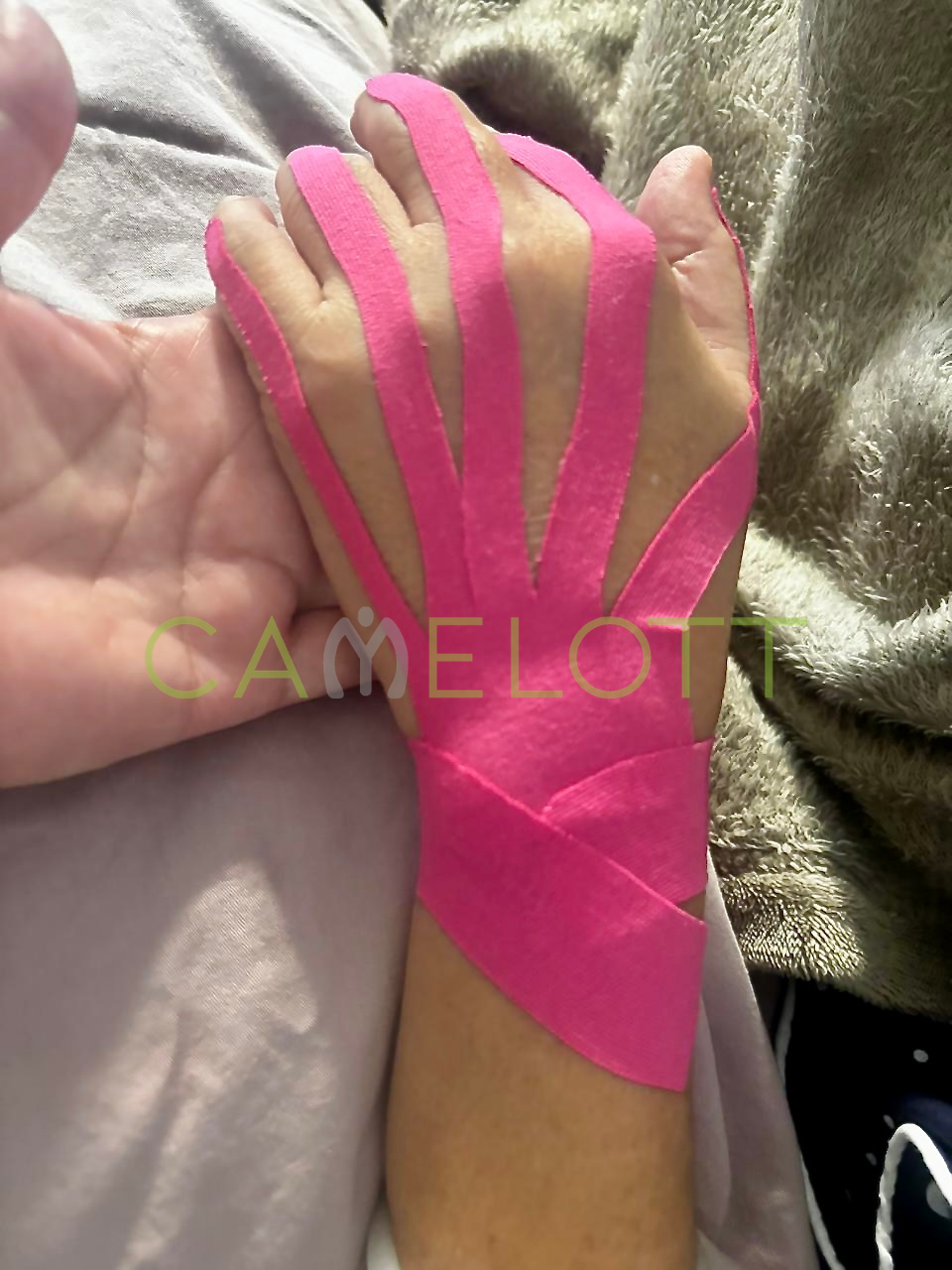 Kinesiotaping
